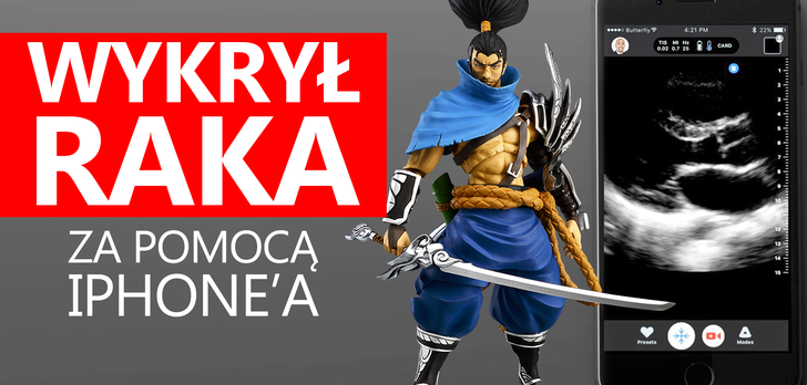 Wykrył u Siebie Raka za Pomocą iPhone'a!