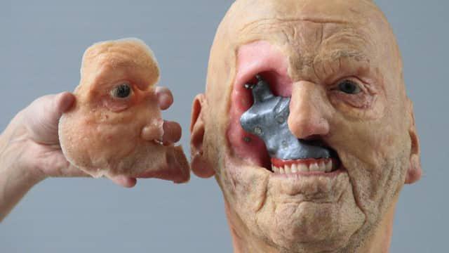 Szpitale masowo drukują części ciała – technologia druku 3D rozkwita