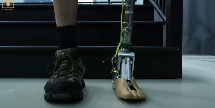 Protetyczna kostka nowej generacji